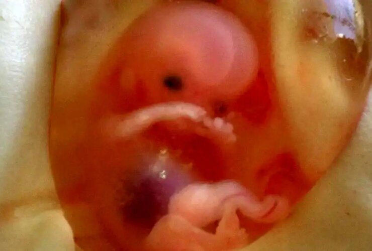 تیم نظارت وزارت بهداشت به داستان از دست دادن جنین های یخ زده می آید 29 تیم نظارت وزارت بهداشت به داستان از دست دادن جنین های یخ زده می آید