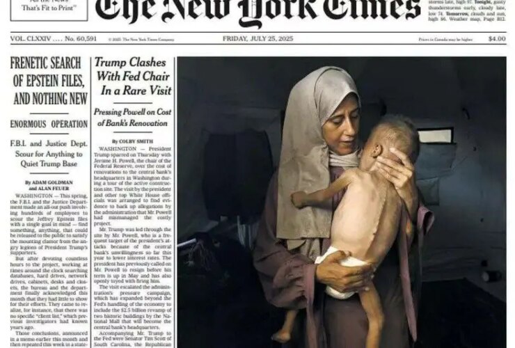 جزئیات جدید و تکان دهنده از عوارض سوء تغذیه کودک غزه 23 غزه