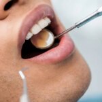 استرس چگونه دندان های شما را از بین می برد؟