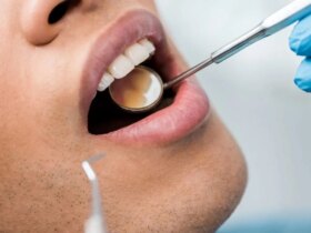 استرس چگونه دندان های شما را از بین می برد؟