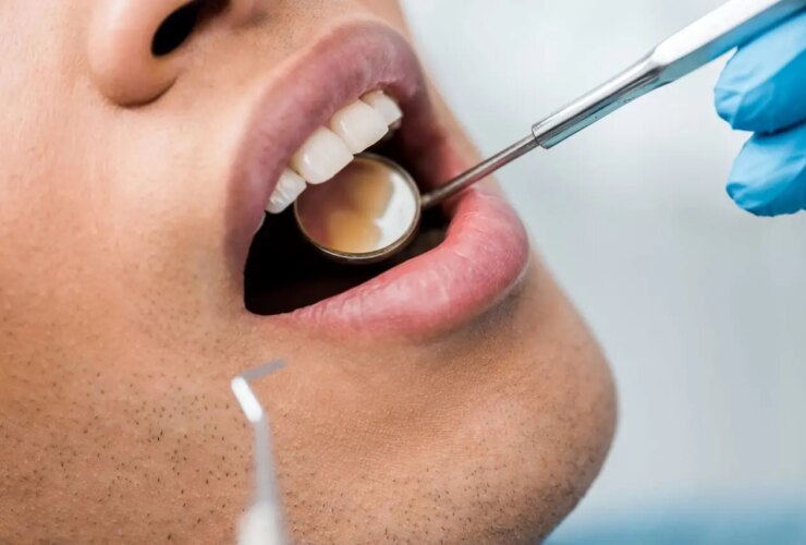 استرس چگونه دندان های شما را از بین می برد؟