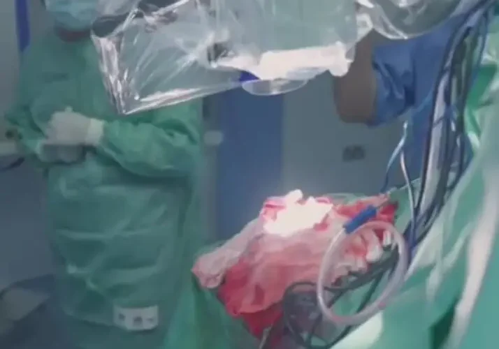 برای دیدن بیماری عجیب بیمار هنگام برداشت تومور مغزی