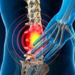 مهمترین علائم اخبار دیسک کمر!