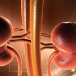 پیوند کلیه ؛ ترکیبی از علم و خود