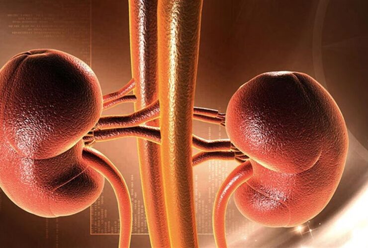 پیوند کلیه ؛ ترکیبی از علم و خود