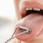 علائم محرک سرطان زبان چیست؟