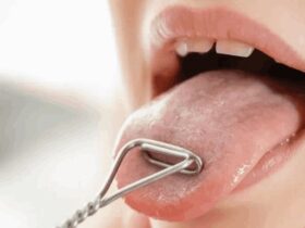 علائم محرک سرطان زبان چیست؟