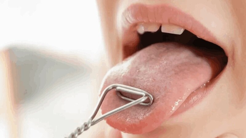 علائم محرک سرطان زبان چیست؟