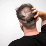 با مصرف نوشیدنی های دسر ، خطر ریزش مو را افزایش دهید