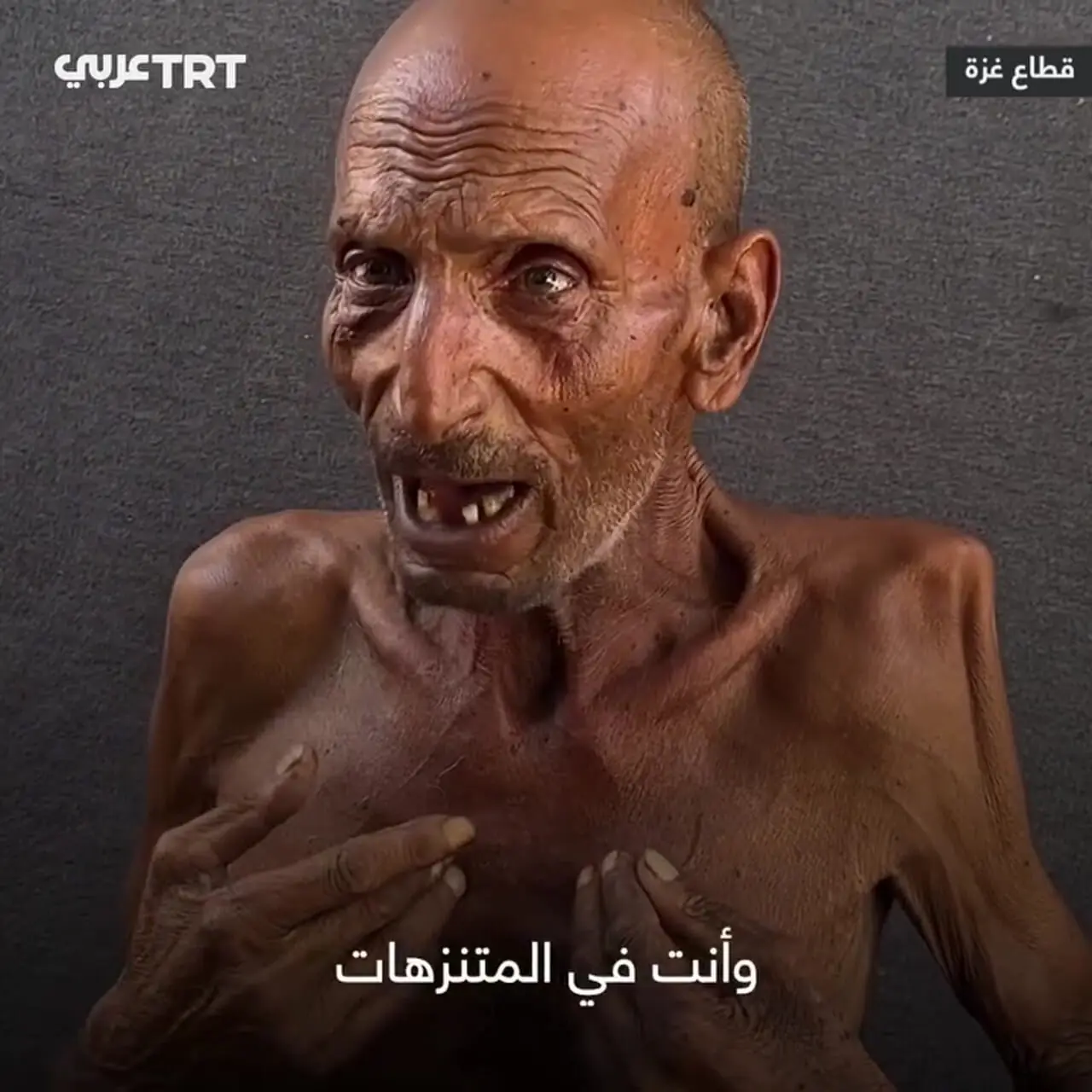 برای دیدن قربانیان سیاست فلسطین در غزه