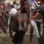 برای دیدن مرگ دلهره آور یک کودک فلسطینی در نتیجه فروپاشی جعبه کمک هوا در سر