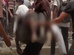 برای دیدن مرگ دلهره آور یک کودک فلسطینی در نتیجه فروپاشی جعبه کمک هوا در سر