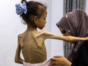 گزارش سخنگوی سازمان ملل در مورد گرسنگی و شکست ناپذیری کافی در غزه