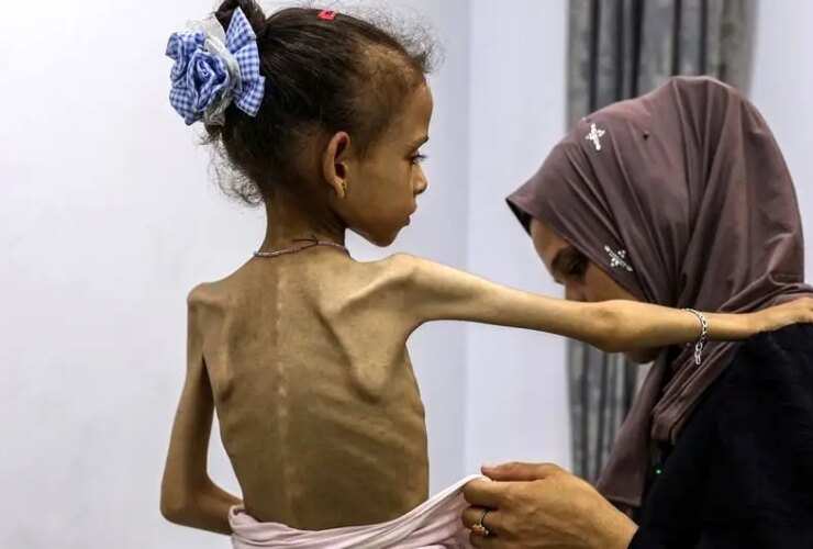 گزارش سخنگوی سازمان ملل در مورد گرسنگی و شکست ناپذیری کافی در غزه 28 گزارش سخنگوی سازمان ملل در مورد گرسنگی و شکست ناپذیری کافی در غزه