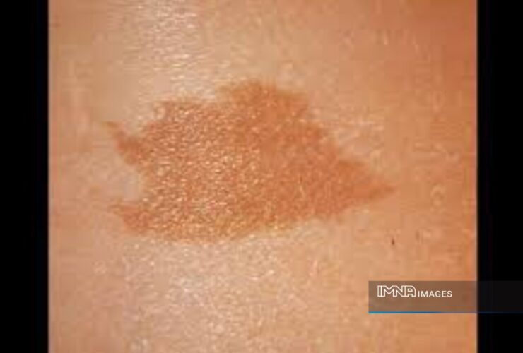 دلیل گرفتگی در بدن کودک چیست؟ | آیا از گرفتگی واقعی جلوگیری می کند؟