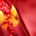 مهمترین راه برای کنترل لیپیدهای خون برای افراد بالای 5 سال