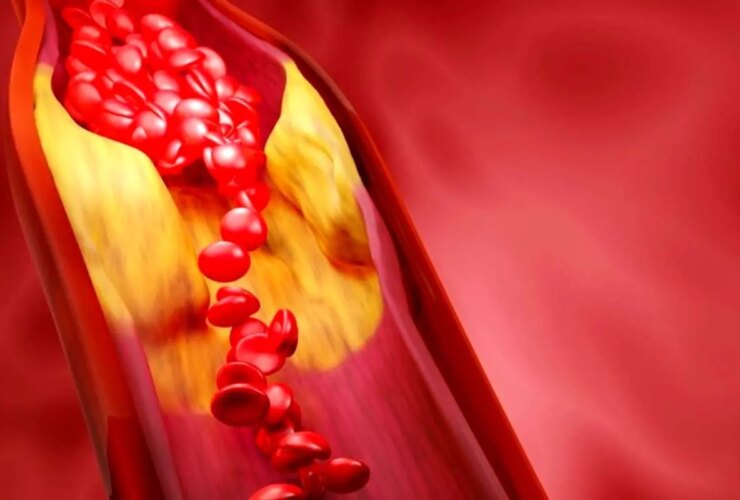 مهمترین راه برای کنترل لیپیدهای خون برای افراد بالای 5 سال