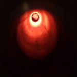 63577251