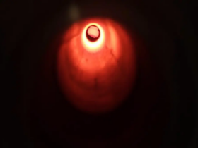 63577251