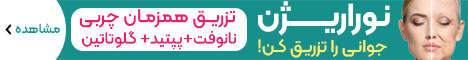 سنی تصادفی