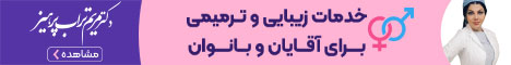 تجارت تجارت تصادفی