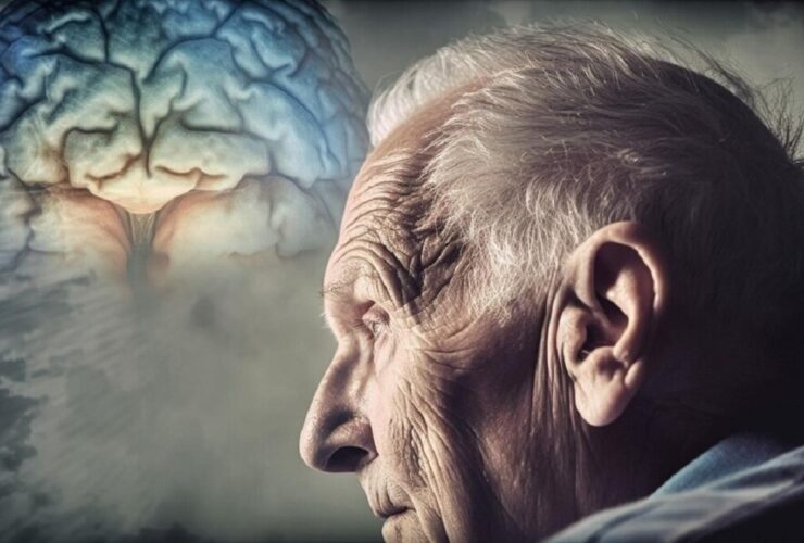 سلولهای مغزی در راه تخریب تدریجی