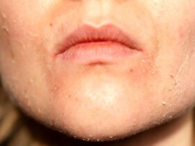 روشهای ساده برای کاهش پوست خشک در پاییز