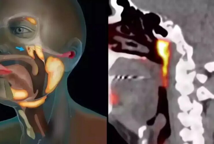 بعد از 300 سال بدن جدیدی را در بدن کشف کنید! 26 بعد از 300 سال بدن جدیدی را در بدن کشف کنید!