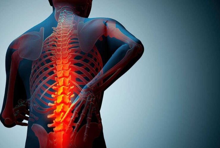 پوکی استخوان یک بیماری ساکت است