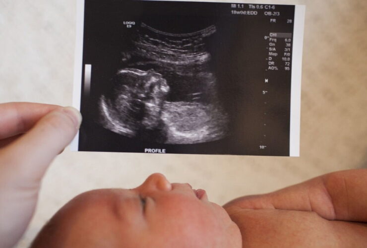 تأثیر عوامل سبک زندگی بر بروز اختلالات هورمونی و عملکردی ناشی از ناباروری/چاقی 6 تأثیر عوامل سبک زندگی بر بروز اختلالات هورمونی و عملکردی ناشی از ناباروری/چاقی