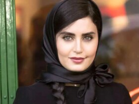 الناز شاکردوست سبیل دارد!