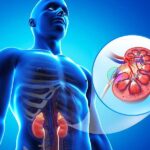 علائم اولیه مشکلات کلیوی چیست؟