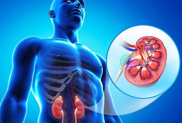 علائم اولیه مشکلات کلیوی چیست؟ 12 علائم اولیه مشکلات کلیوی چیست؟