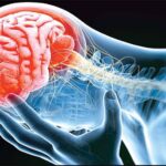 علائم سکته مغزی چیست؟ / سکته مغزی محدود به سن خاصی نیست