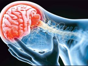 علائم سکته مغزی چیست؟ / سکته مغزی محدود به سن خاصی نیست 8 علائم سکته مغزی چیست؟ / سکته مغزی محدود به سن خاصی نیست