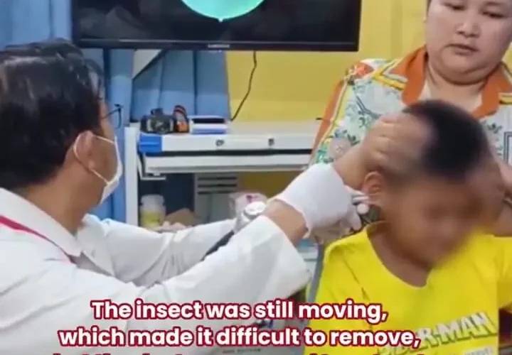 برای دیدن؛ خارج کردن سوسک زنده از گوش کودک 26 برای دیدن؛ خارج کردن سوسک زنده از گوش کودک