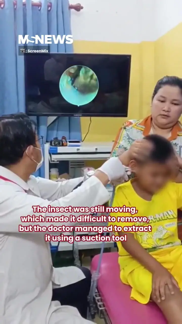 برای دیدن؛ خارج کردن سوسک زنده از گوش کودک 1 برای دیدن؛ خارج کردن سوسک زنده از گوش کودک