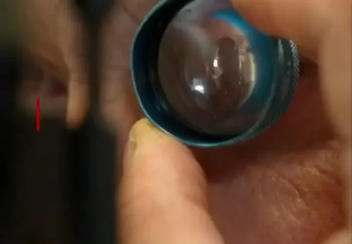 دیدن بعد از 30 سال نابینایی