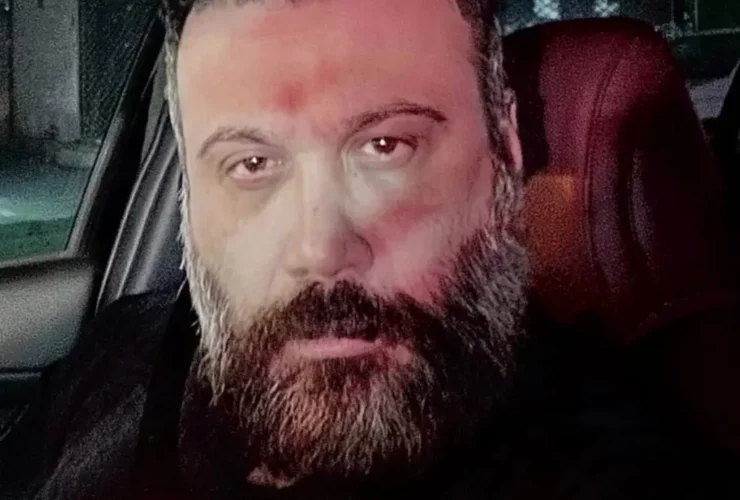 چهره شکسته محسن چاوشی بعد از کار جدیدش