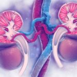 کولیک کلیوی چیست و چگونه تشخیص داده می شود؟