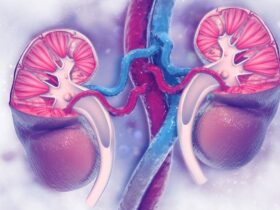 کولیک کلیوی چیست و چگونه تشخیص داده می شود؟ 8 کولیک کلیوی چیست و چگونه تشخیص داده می شود؟