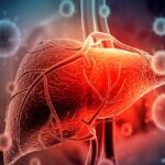 اغلب علائم اولیه بیماری های کبدی نادیده گرفته می شود