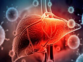 اغلب علائم اولیه بیماری های کبدی نادیده گرفته می شود