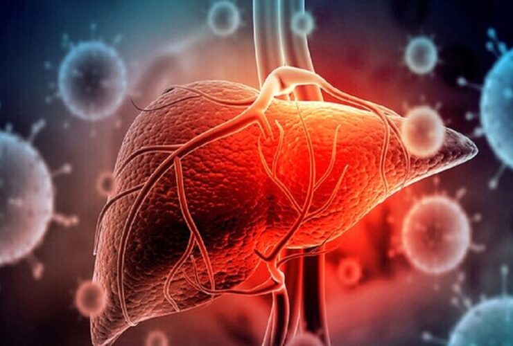 اغلب علائم اولیه بیماری های کبدی نادیده گرفته می شود 15 اغلب علائم اولیه بیماری های کبدی نادیده گرفته می شود