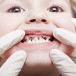 اولین معاینه دندان کودک چه زمانی باید انجام شود؟