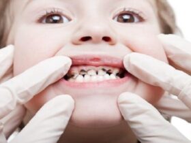 اولین معاینه دندان کودک چه زمانی باید انجام شود؟ 8 اولین معاینه دندان کودک چه زمانی باید انجام شود؟