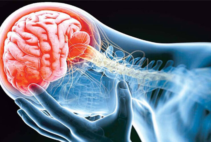 علائم تومور مغزی؛ از تغییرات بینایی گرفته تا اختلالات شناختی 27 علائم تومور مغزی؛ از تغییرات بینایی گرفته تا اختلالات شناختی
