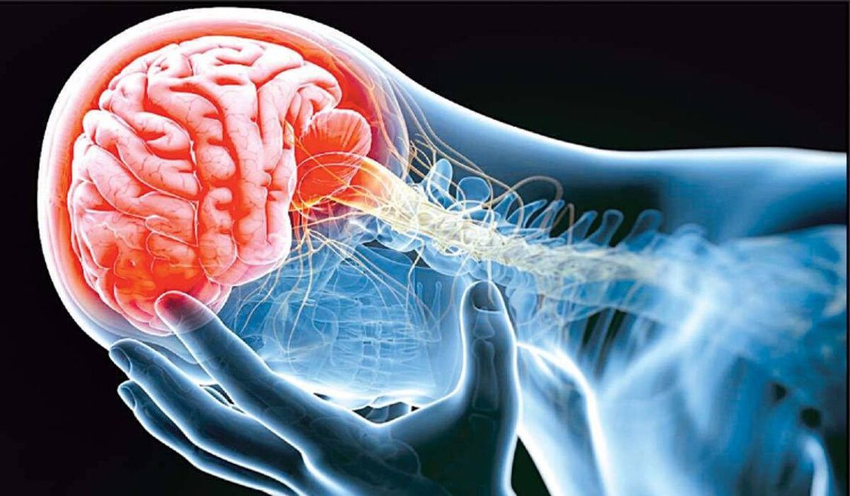 علائم تومور مغزی؛ از تغییرات بینایی گرفته تا اختلالات شناختی 1 علائم تومور مغزی؛ از تغییرات بینایی گرفته تا اختلالات شناختی
