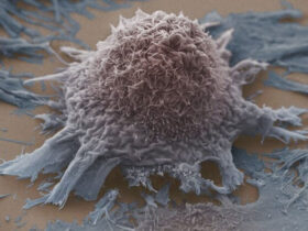 توجه به تراکم استخوان و جلوگیری از تخریب آن در بیماران سرطانی ضروری است. 8 توجه به تراکم استخوان و جلوگیری از تخریب آن در بیماران سرطانی ضروری است.