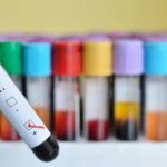 کمپین «من هم آزمایش اچ‌آی‌وی می‌گیرم» از امروز تا 30 آذرماه آغاز می‌شود